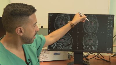 Carlos Fuentes, Neurocirujano, señala partes del cerebro en una resonancia. /  Aragón TV